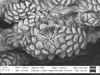 Media type: image;   Invertebrate Zoology 32029 Description: SEM image of specimen.;  Aspect: dorsal